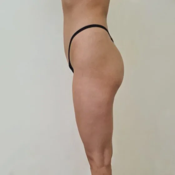 До/після процедури