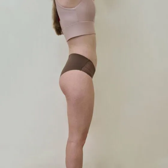 До/після процедури