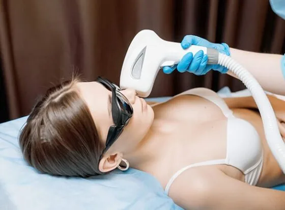 лазерна епіляція