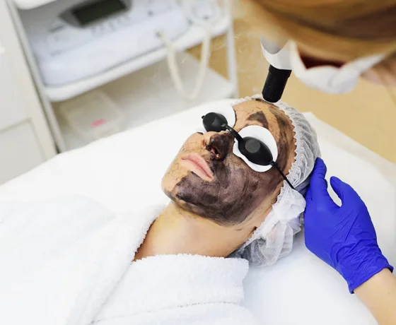 карбоновый пиллинг лица