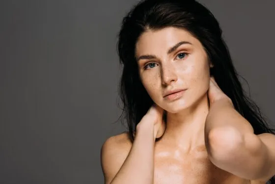 Пігментні плями на обличчі