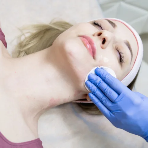 Пілінг чистка