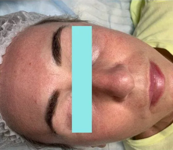 До видалення перманентного макіяжу